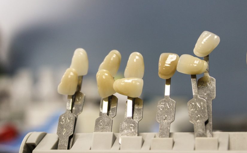 Piękne nienaganne zęby dodatkowo świetny prześliczny uśmieszek to powód do dumy.